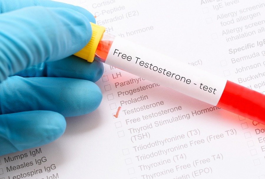 FREE TESTOSTERONE